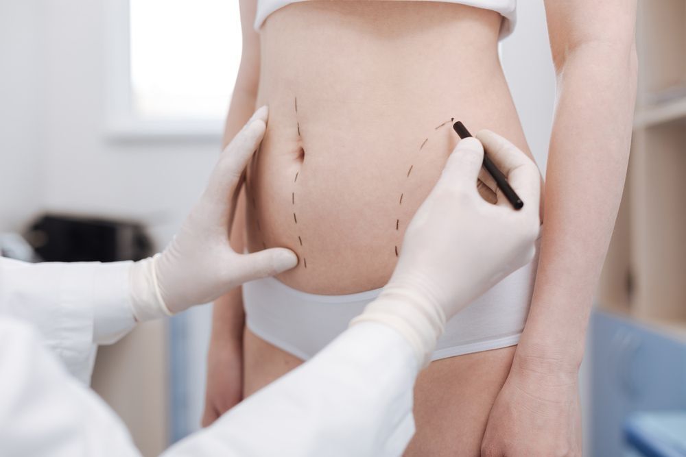 Liposuction negligence resources - Cosmetic Surgery Solicitors